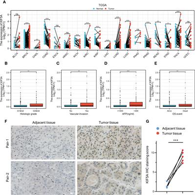 KIF5A upregulation in hepatocellular carcinoma: A novel prognostic biomarker associated with unique tumor microenvironment status